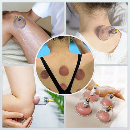 Suction Cups Massage