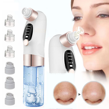 Blackhead Remover